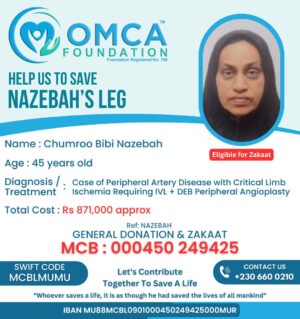 help save nazebah’s leg – urgent peripheral angioplasty treatment