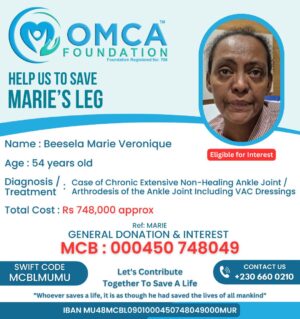 help save marie’s leg – urgent ankle surgery & treatment