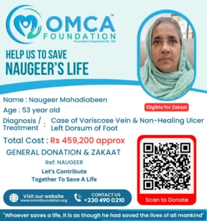 Help Save Mahadiabeen’s Life – Urgent Varicose Vein & Foot Ulcer Treatment Support